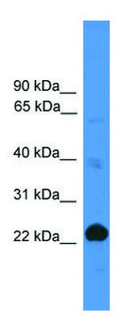 Anti-CD8A antibody produced in rabbit
