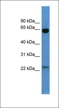 Anti-BAIAP2 antibody produced in rabbit