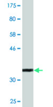 Monoclonal Anti-RCBTB1 antibody produced in