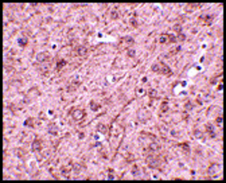Anti-LASS6 antibody produced in rabbit