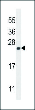 ANTI-CALML4 (C-TERM) antibody produced in