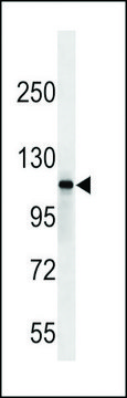 ANTI-SIK2 (CENTER) antibody produced in