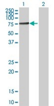 Anti-TKT antibody produced in rabbit