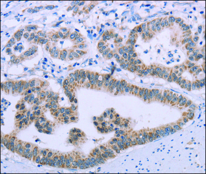 Anti-MRGPRX1 antibody produced in rabbit