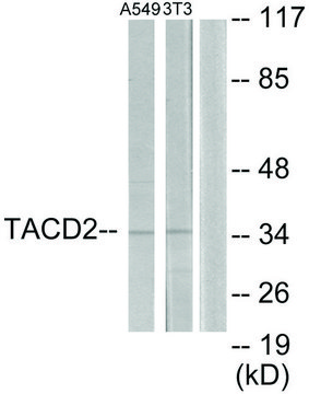 Anti-TACD2 antibody produced in rabbit