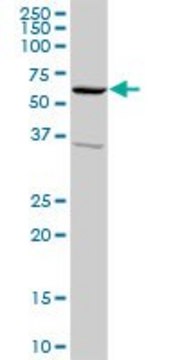 Anti-SNX4 antibody produced in rabbit