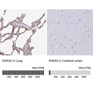 Anti-ANXA2