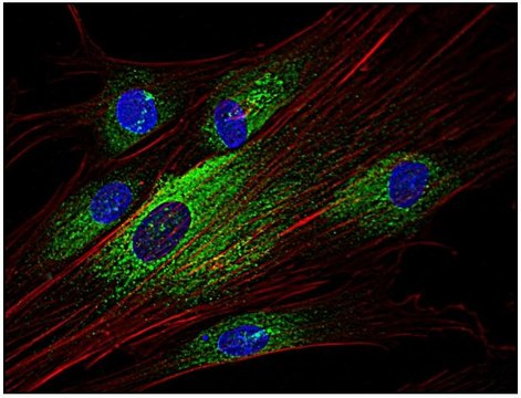 Monoclonal Anti-SYK antibody produced in