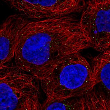 Anti-ORM1 antibody produced in rabbit