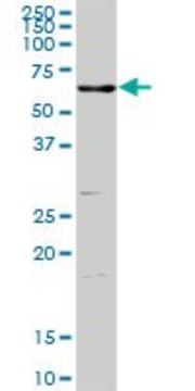 Anti-ENTPD3 antibody produced in rabbit