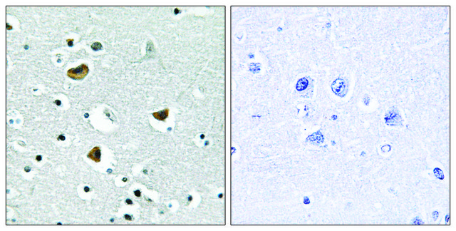 Anti-HMG17 antibody produced in rabbit