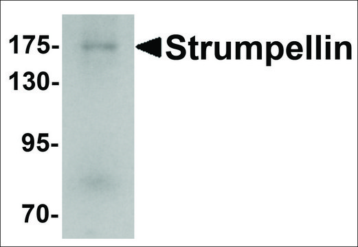 Anti-KIAA0196 antibody produced in rabbit