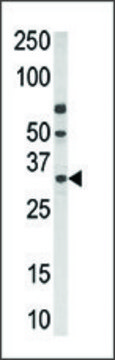 Anti-PPT2 (N-term) antibody produced in