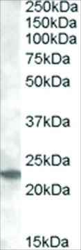 Anti-RAB17 antibody produced in goat