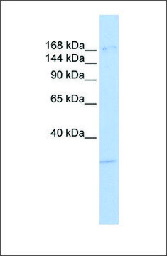 Anti-UTX antibody produced in rabbit