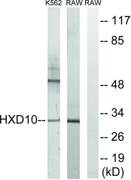 Anti-HOXD10 antibody produced in rabbit