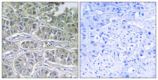 Anti-SLC25A21 antibody produced in rabbit