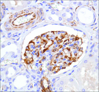 Anti-Nestin antibody, Rabbit monoclonal