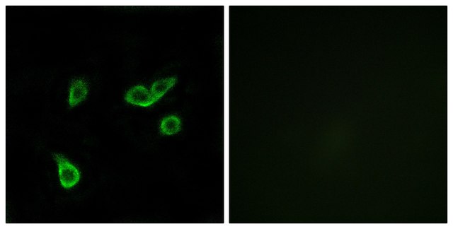 Anti-GPR35 antibody produced in rabbit