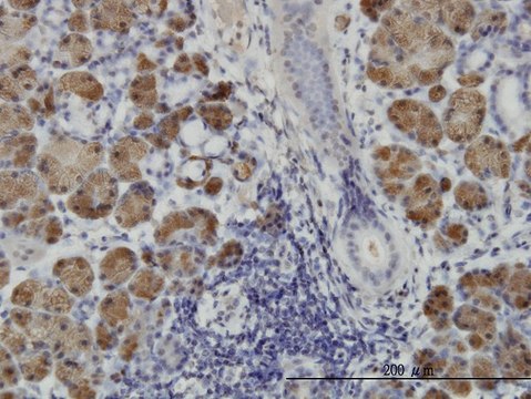 Monoclonal Anti-HIPK1 antibody produced in
