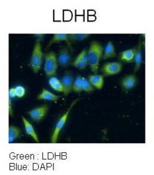 Anti-LDHB