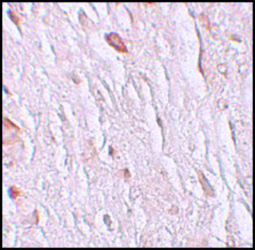 Anti-ZIP7 antibody produced in rabbit
