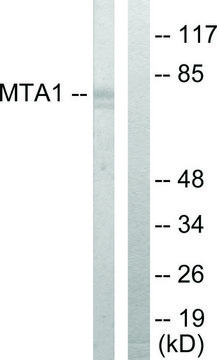 Anti-MTA1 antibody produced in rabbit