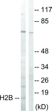 Anti-Histone H2B antibody produced in
