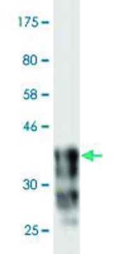 Monoclonal Anti-CDH18 antibody produced in