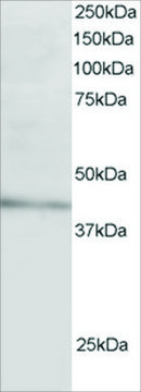 Anti-ARH/LDL Receptor Adaptor antibody produced