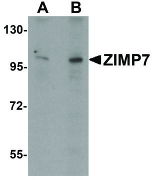 Anti-ZIMP7 antibody produced in rabbit
