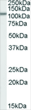 Anti-SMEK1/KIAA2010 antibody produced in goat