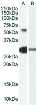 Anti-CHA/TCFL5 antibody produced in goat
