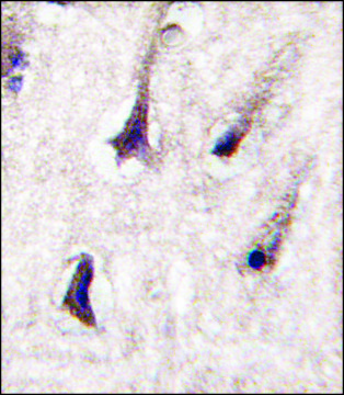 ANTI-PKC BETA2(C-TERMINAL) antibody produced in