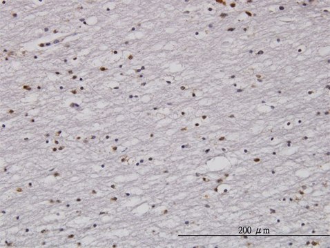 Monoclonal Anti-RAD1, (N-terminal) antibody produced
