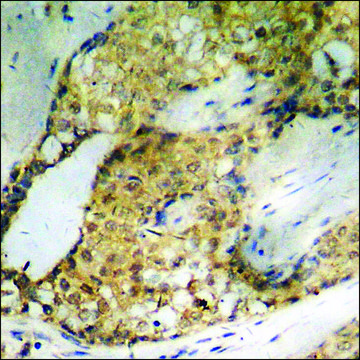 Anti-phospho-ATF2 (pSer62 or 44) antibody