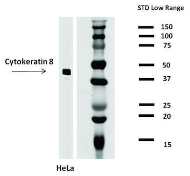 Monoclonal Anti-Cytokeratin 8 antibody produced