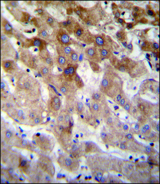 ANTI-MBTD1 (C-TERM) antibody produced in