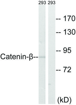 Anti-Catenin-? antibody produced in rabbit