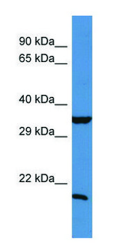 Anti-TIMP1 (N-terminal) antibody produced in