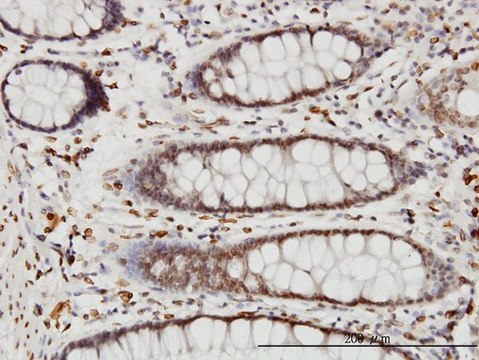 Monoclonal Anti-WDR20 antibody produced in