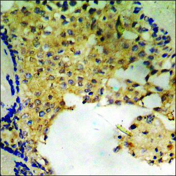 Anti-phospho-Smad2 (pSer²??) antibody produced in