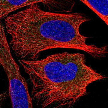 Anti-CHMP2B antibody produced in rabbit