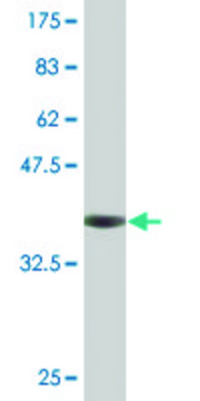 Monoclonal Anti-CDY2A antibody produced in