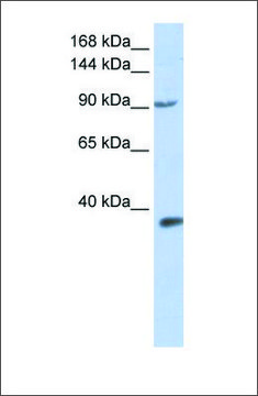 Anti-EPAS1 antibody produced in rabbit