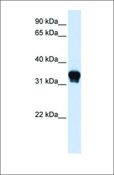 Anti-CSNK1A1 antibody produced in rabbit