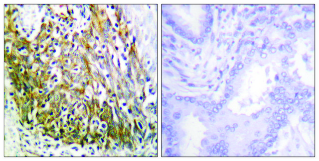 Anti-MMP-10 antibody produced in rabbit
