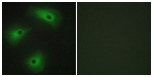 Anti-TM16A antibody produced in rabbit