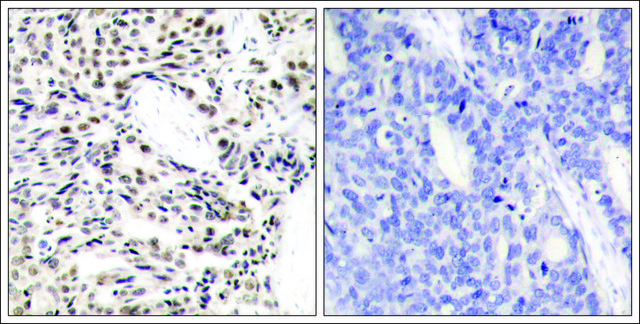 Anti-RELA (Ab-529) antibody produced in