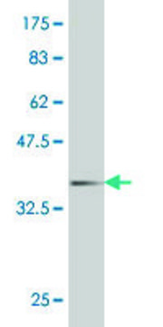 ANTI-HD antibody produced in mouse